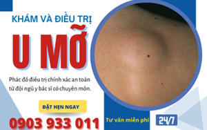 U MỠ: NGUYÊN NHÂN, TRIỆU CHỨNG, CÁCH ĐIỀU TRỊ DỨT ĐIỂM